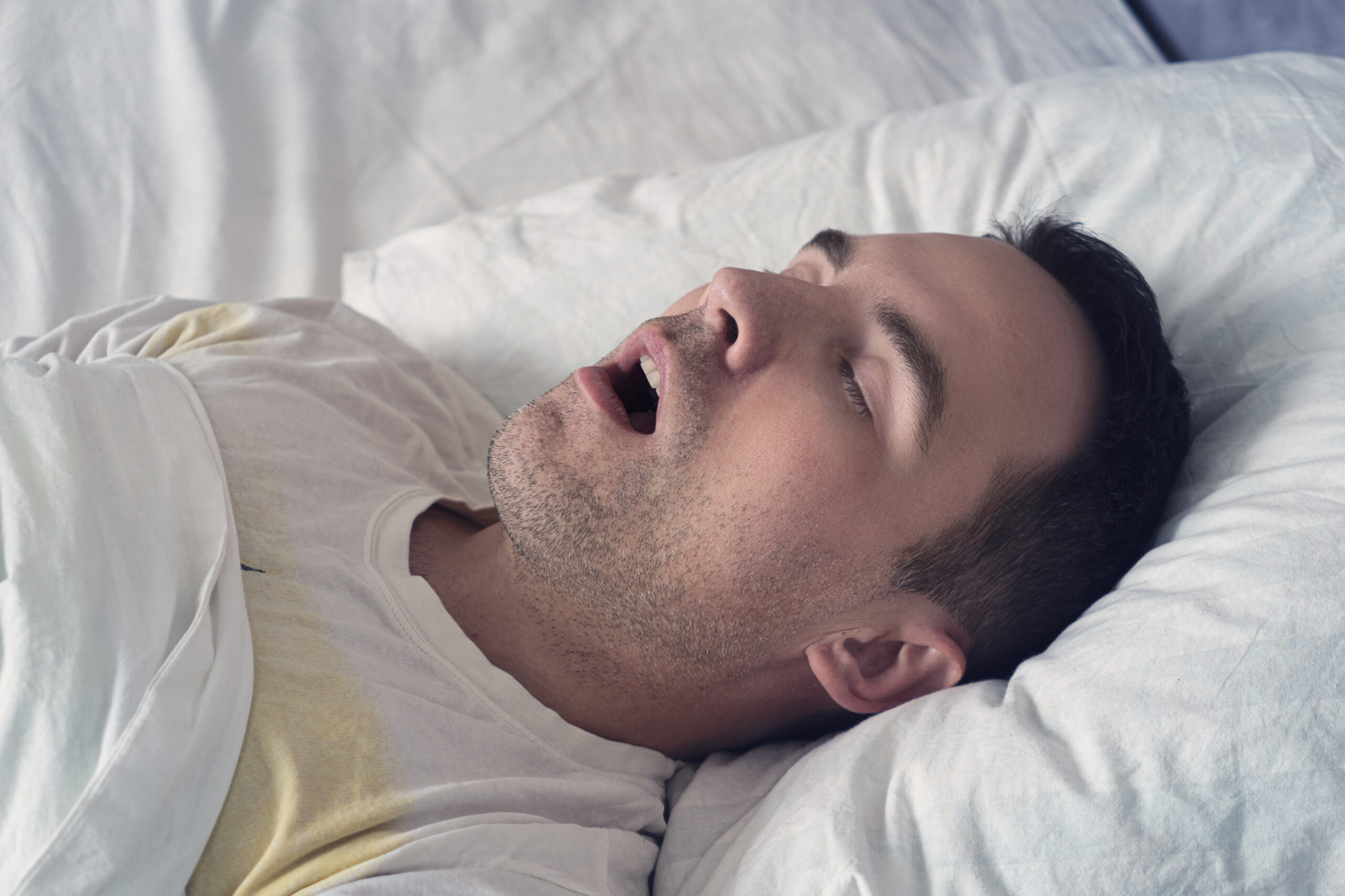 Apnées du sommeil : une maladie respiratoire très largement sous-diagnostiquée !